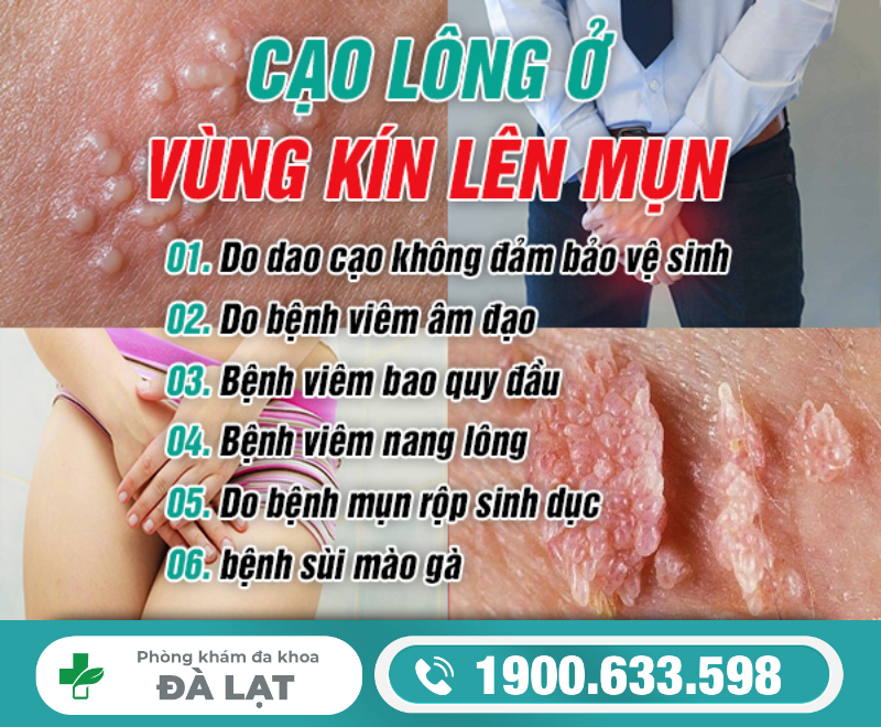 CẠO LÔNG VÙNG KÍN BỊ LÊN MỤN: NGUYÊN NHÂN DO ĐÂU?